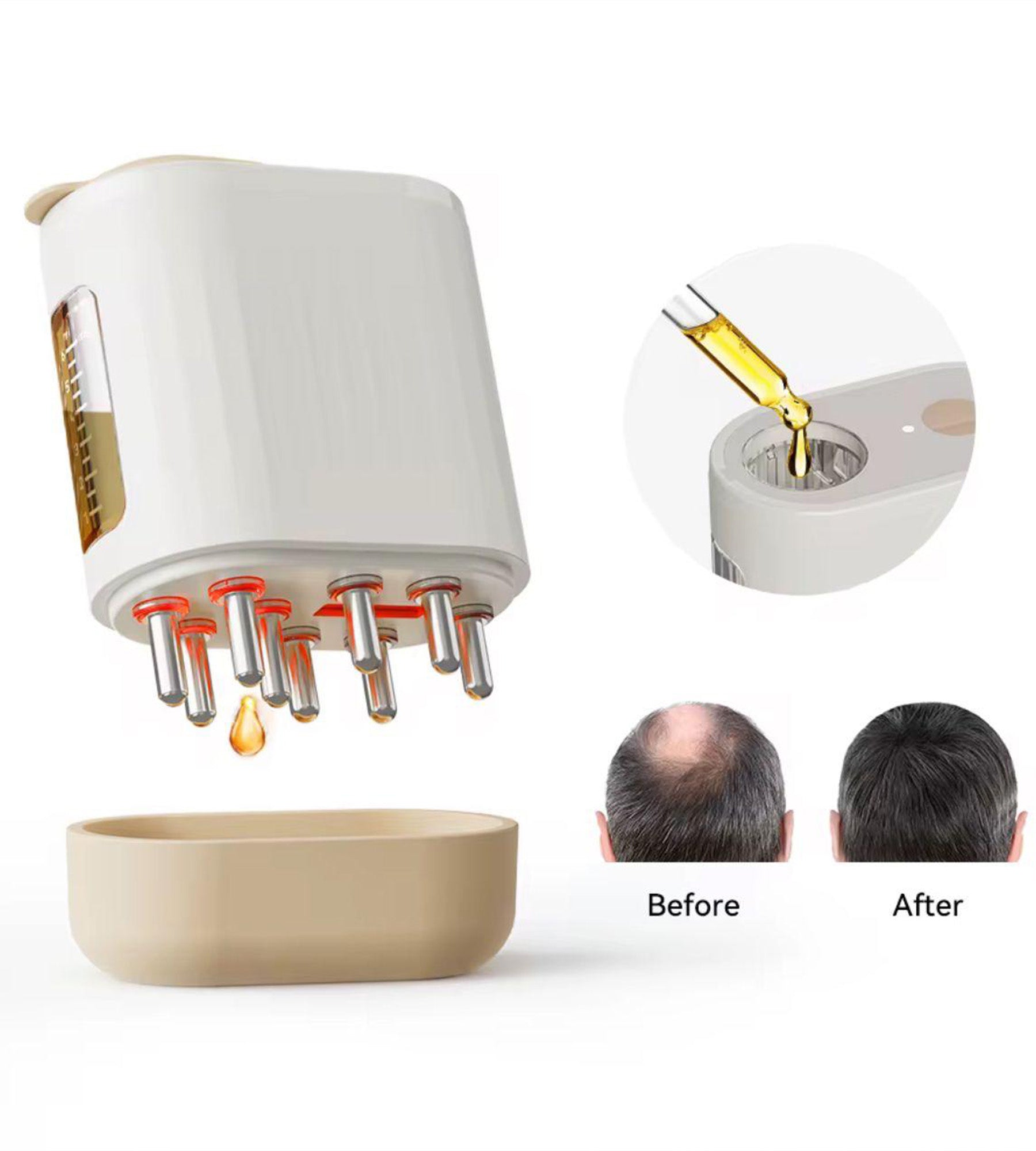 Electric scalp massager/liquid diffuser with red light